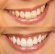 Dentway Starter Kit Dentway Starter Kit